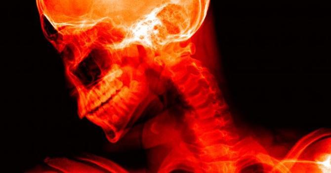 L'analyse radiologique chiropratique : ce qu'il faut savoir