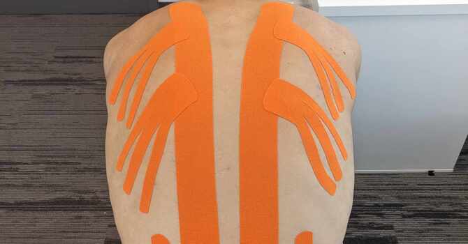 Kinesiotaping : quand, comment et pourquoi l'utiliser? image