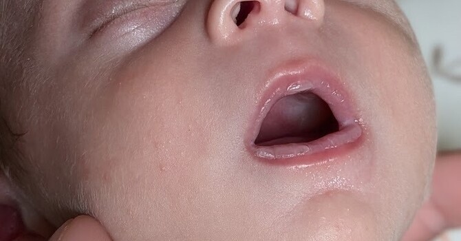 Le suivi chiropratique : débuter après la naissance